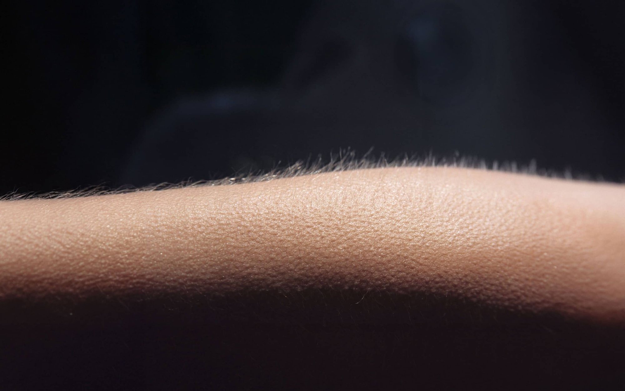 Arm mit Gänsehaut
